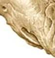 Cresta supramastoidea Escama Borde parietal Fosa temporal Apófisis cigomática Foramen