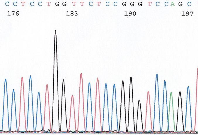 WT exon 41 COL4A5 gene GCCAAAAGGGTGATGGAGGATTACCTGGGATTCCAGGAAATCCTGGCCTTCCAGGT