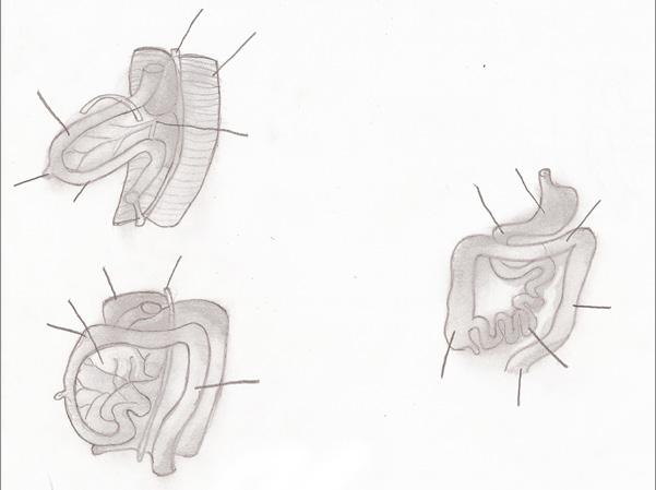 b) Resuma las fases de la herniación fisiológica que se presentan en la figura 10.