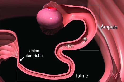 Oviductos APARATO REPRODUCTOR FEMENINO Órganos tubulares que conectan el útero