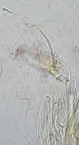 radiata que crece en gimnospermas correspondería a la S. carestiae (= Schmitzomia carestiae De Not. -1863-) Hábitat y loc.: VALÈNCIA. El Saler. Tallafoc de la Rambla. 30S YJ3061; 3 m.