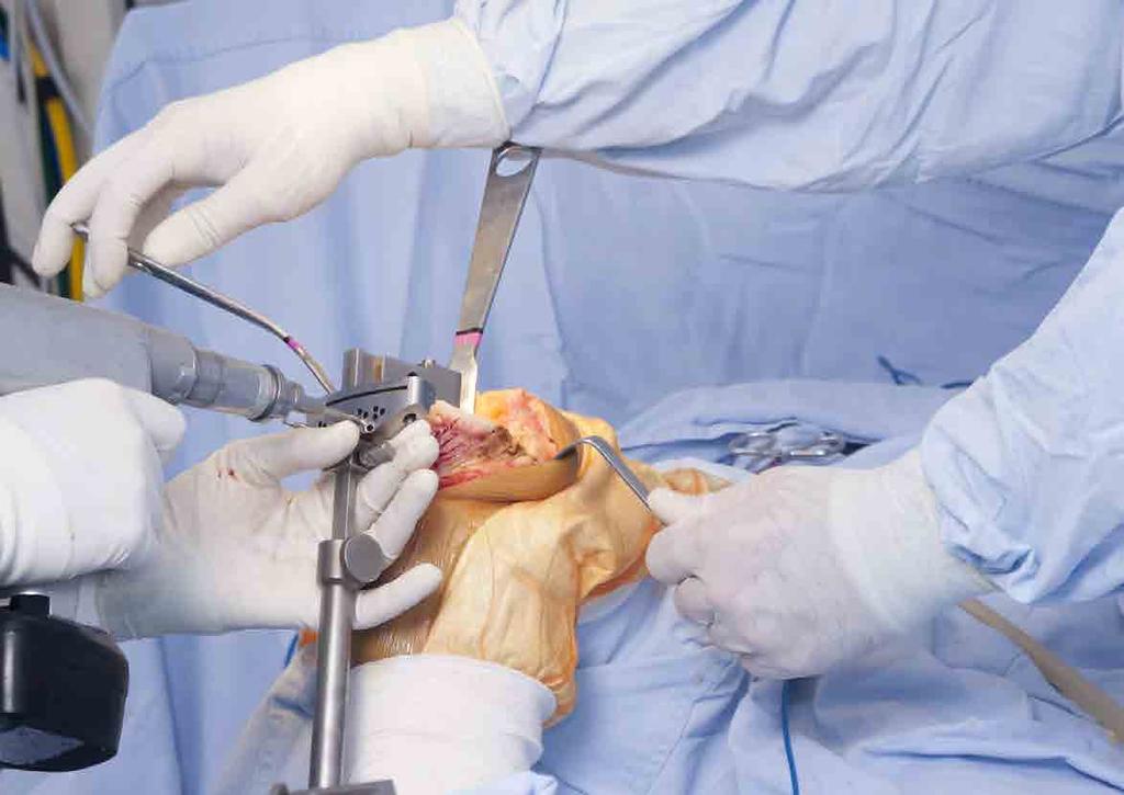 Diplomado en Cirugía Ortopédica