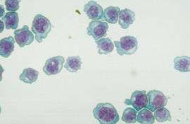 Células HL-60 (efectoras) Promielocitos leucemoides Maduración