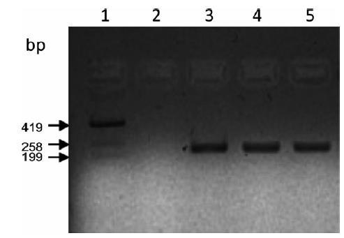 Identificación de genes tipo pira y pirb en cepas de Micrococcus luteus en México AHPND/EMS China, 2009 México, 2013 Micrococcus luteus Nayarit, 2006 pira y pirb presentes AP4 método