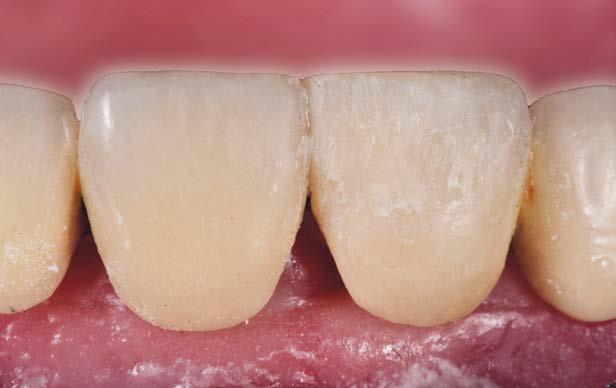 información sobre la forma primaria del diente.