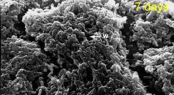 Formación de biofilms Formación de un biofilm delisteria monocytogenes a 20 C sobre acero inoxidable. 7 días. SEM micrographs: P. Chavant, M.