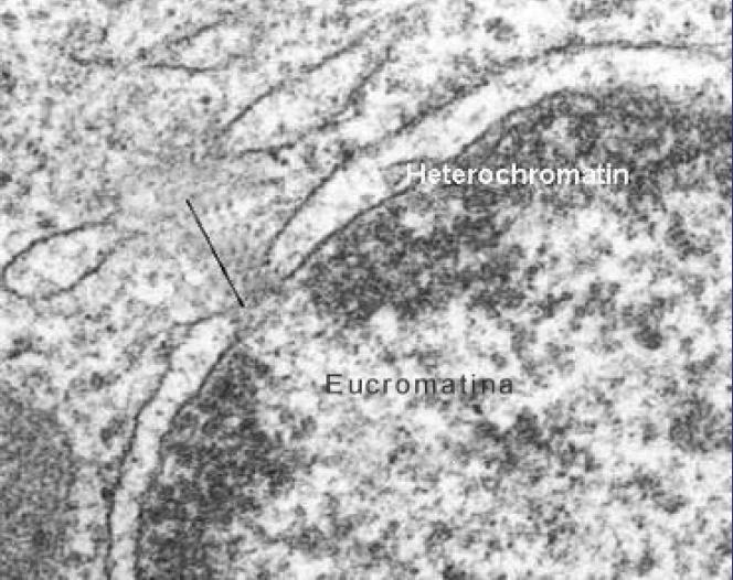 localización central, y la heterocromatina o cromatina