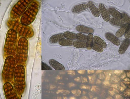 Descripción microscópica Ascas anchamente elípticas, bitunicados, 8 esporas, biseriadas, no amiloides, de hasta 152 x 53 µm, en los ejemplares vistos.