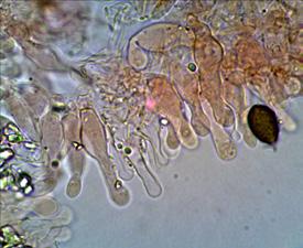 amb un porus germinatiu gros (fins 2 µm) i central, de 11 5-14 2 x 7 4-8 7 x 6 3-8 µm; amb valors mitjans de 13 x 8 x 7 µm.