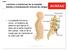 Lesiones y trastornos de la espalda debido a manipulación manual de cargas