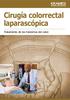 Cirugía colorrectal laparascópica. Tratamiento de los trastornos del colon