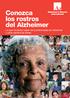 Conozca los rostros del Alzheimer. Lo que necesitas saber de la enfermedad de Alzheimer y otras demencias afines