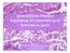 Síndrome de Lynch. Datos clínicos y morfológicos del carcinoma endometrial en el Sindrome de lynch. Implicaciones para test genético