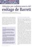 esófago de Barrett Ablación por radiofrecuencia del El lugar en terapéutica de... Características del esófago de Barrett