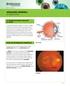 retinopatía diabética un vistazo a fondo
