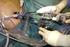 Colecistectomía por laparoscopia de puerto único a través de un guante quirúrgico