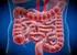 Síndrome de intestino corto: definición, causas, adaptación intestinal y sobrecrecimiento bacteriano