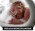 Vitamina A y displasia broncopulmonar en recién nacidos de muy bajo peso al nacer