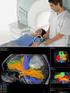 Aportes de la espectroscopía por resonancia magnética en las lesiones cerebrales
