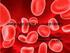 Nombre de la enfermedad: Anemia de Célula Falciforme SCD (en inglés)