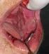 Diagnóstico a tener en cuenta en lesiones orales