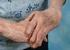 La artritis reumatoide