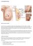 CANCER DE MAMA. Qué es un cáncer de mama?
