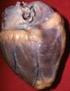 ANATOMÍA CARDÍACA. Describiremos a continuación la anatomía de las cavidades cardíacas y sus grandes arterias. Aurícula derecha: