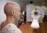 Cambios tras el tratamiento con radioterapia en los tumores de cabeza y cuello. Algo más que la recurrencia.