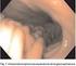 Endoscopia esofagogastroduodenal