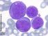 Leucemia aguda mieloide M3 (promielocítica)