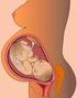 Proceso por el cual el feto transita desde la cavidad uterina hasta el exterior del organismo materno.