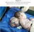 El diagnóstico prenatal de defectos cromosómicos en Costa Rica