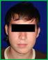 Relación Entre el Tamaño Condilar y la Asimetría Facial Transversal en Individuos con Hiperplasia Condilar