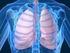 Manejo del Tromboembolismo Pulmonar