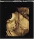 Evaluación prenatal del paladar duro y blando mediante reconstrucción tridimensional