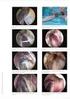 Endoscopia transvaginal TVE GYN /2015-ES