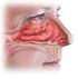 Es una enfermedad que afecta a la mucosa nasal y produce estornudos, comezón, obstrucción nasal, secreciones nasales y en ocasiones falta de olfato.