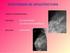 Diagnóstico por imagen de las lesiones benignas del conducto auditivo externo