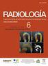 RADIOLOGÍA.  Resonancia magnética artrografía de cadera con énfasis en el atrapamiento femoroacetabular