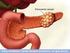 Cáncer de Pancreas Adyuvante