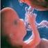 Teórica de Desarrollo embrionario