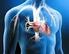 Hipertensión pulmonar tromboembólica crónica