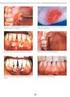 Ortodoncia, cirugía, periodoncia mucogingival, implantología y prótesis