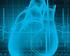 Introducción. Artículo: Fibrilación auricular y riesgo de infarto de miocardio (Cortesía de IntraMed.com)