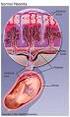 Origen fetal de la disfunción placentaria: el caso de la RCIU. Dra. Paola Casanello