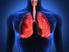 Tratamiento de la fibrosis pulmonar idiopática