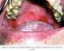 Referencias. Trastornos de la cavidad oral