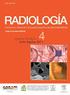 Actualización de los criterios radiológicos diagnósticos en Esclerosis Múltiple