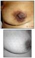 Contenido. iii. 1. Introducción a la ecografía mamaria Requisitos de los equipos de la ecografía de mama... 16